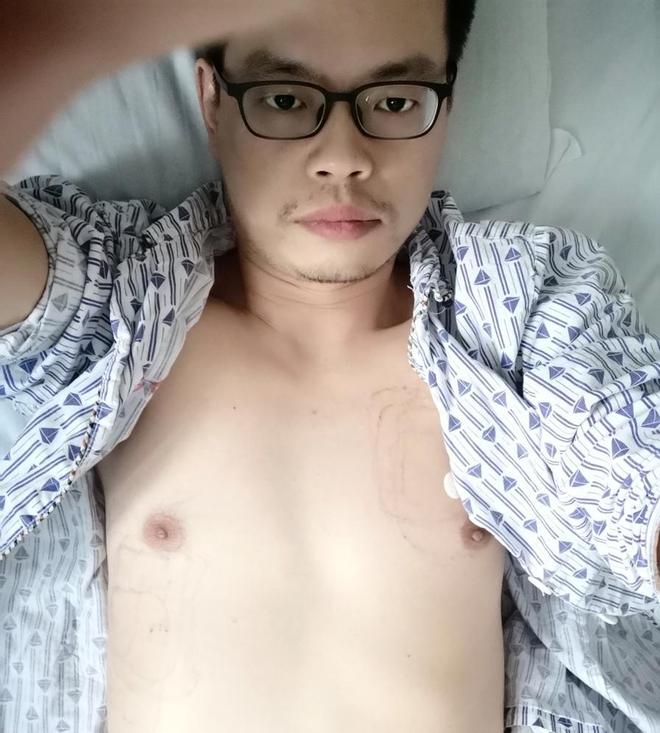 星欧注册：40岁心梗幸存者已离职回村静养，医生回忆抢救过程并提醒：每个人都该保存一份自己健康状态下的心电图